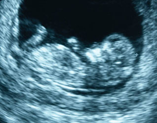 Human Fetus